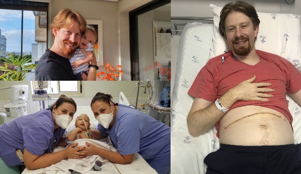 Pai doa parte do fígado para filho de quatro meses com grave doença genética_