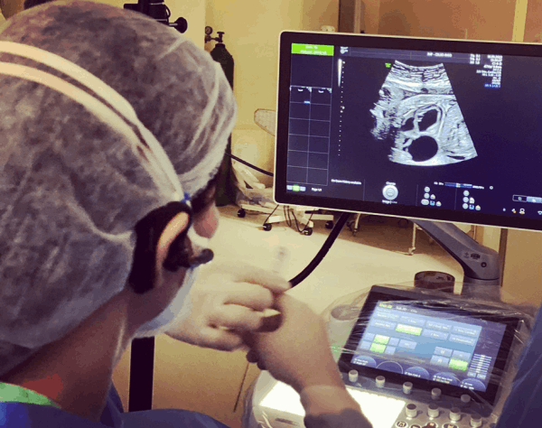 Santa Casa de Porto Alegre realiza primeira cirurgia fetal de coração-